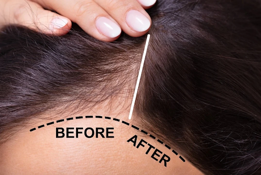 Can keratin treatment repair damage or just mask it